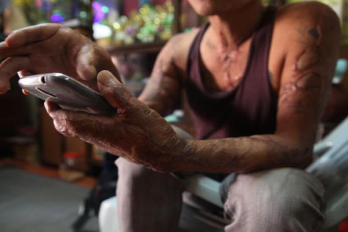 နေအိမ်တွင် တယ်လီဖုန်း အသုံးပြုနေသော အသက် ၄၇နှစ် အရွယ် မီးသတ်တပ်ကြပ်ကြီး ဦးထွန်းထွန်း (ဓာတ်ပုံ - ဝင်းနန္ဒာ / Myanmar Now)