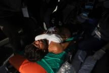ဓါတ်ပုံ။ (AFP) စစ်တပ်အာဏာသိမ်းမှုကိုဆန့်ကျင်ဆန္ဒပြစဉ်အတွင်းဒဏ်ရာရခဲ့သောဆန္ဒပြသူ  တစ်ဦး ဧပြီ ၁ရက်နေ့က မန္တလေးရှိကားတစ်စီးတွင်ဆေးကုသမှုခံယူနေစဉ်။